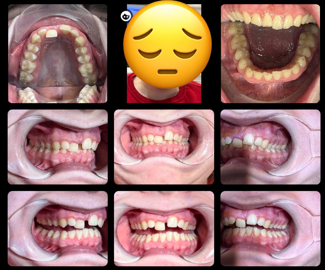 Teeth Straightening Servies